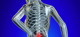 back pain